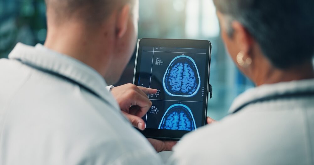 Fibrillazione atriale e salute cognitiva